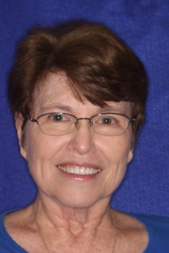 Teeth Restorations in Lafayette | Before & After